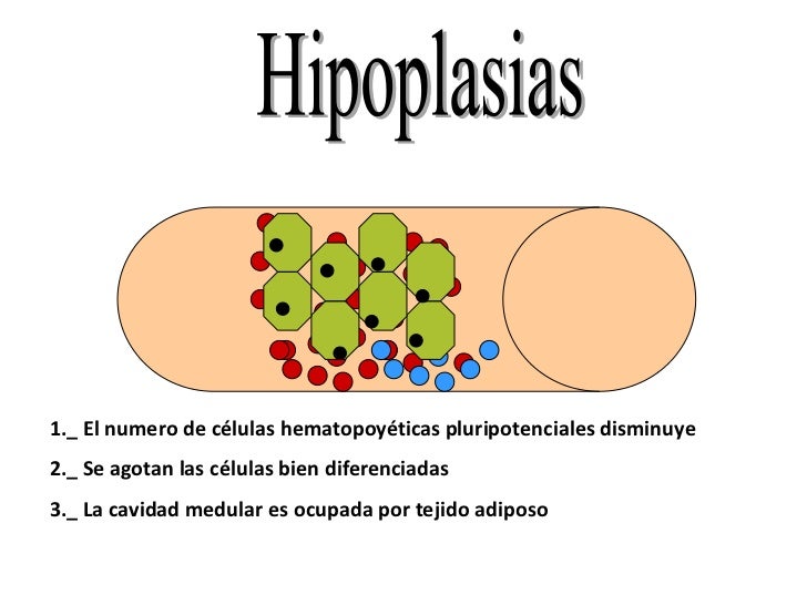 hipoplasia medular